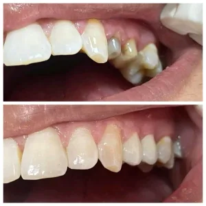 Glory  Dental lab