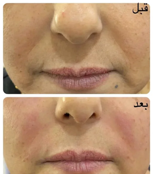 مركز الأطباء الاستشاريون لطب وزراعة الأسنان