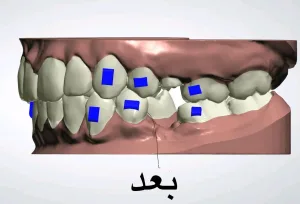 مختبر بيت المقدس لصناعة الأسنان