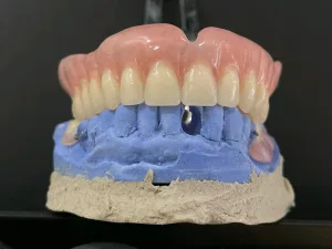 Glory  Dental lab