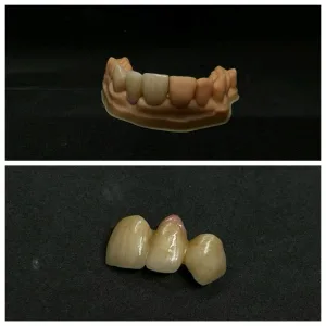 Glory  Dental lab
