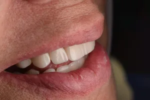 عياده اسنان،  الدكتور مصطفى عبدالرزاق ، طب و جراحه الفم و الاسنان