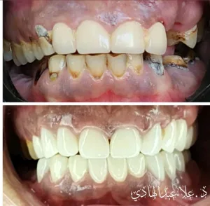dr alaa abdulhadi dental clinic