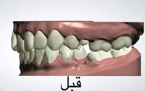 مختبر بيت المقدس لصناعة الأسنان