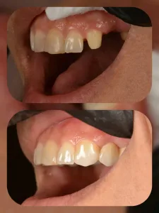 عياده اسنان،  الدكتور مصطفى عبدالرزاق ، طب و جراحه الفم و الاسنان