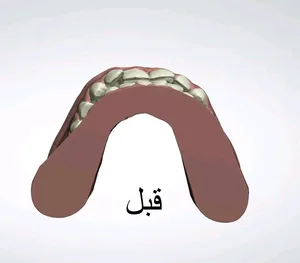 مختبر بيت المقدس لصناعة الأسنان
