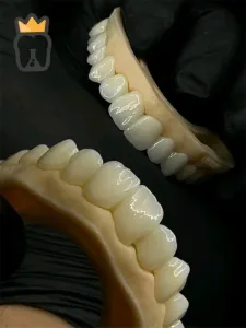 Glory  Dental lab