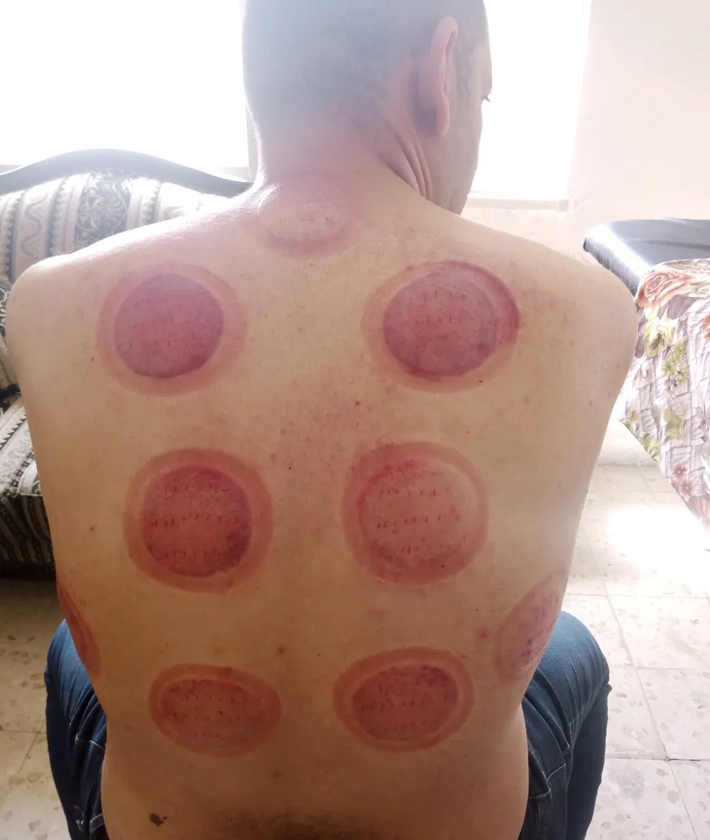 حجامة بأنواعها كايروبرايتيك شياتسو مصل النحل رقية شرعية