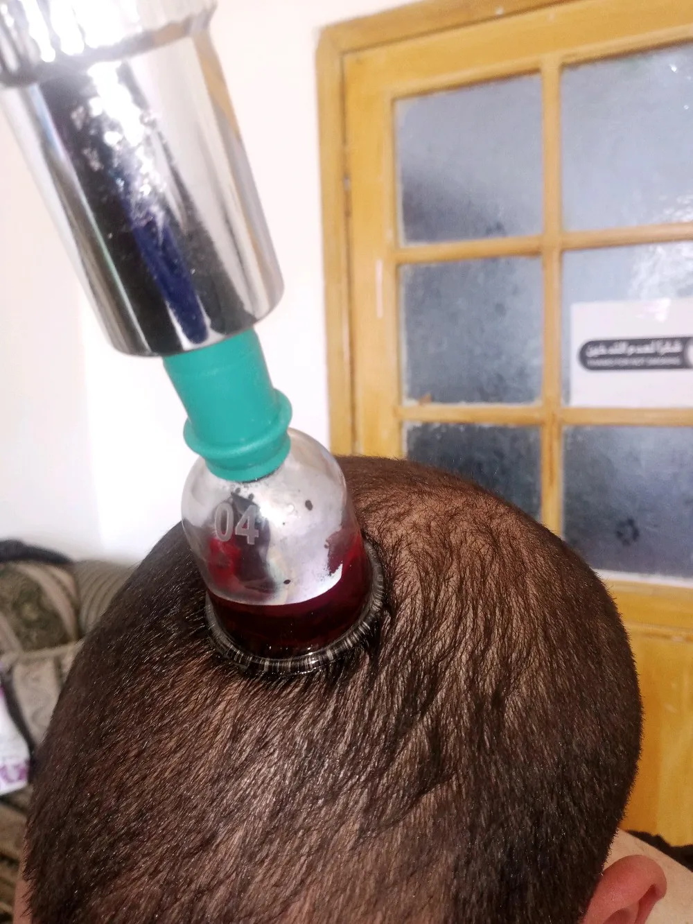 حجامة بأنواعها كايروبرايتيك شياتسو مصل النحل رقية شرعية
