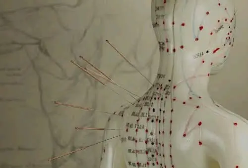 حجامة وطب بديل ومساج علاجي