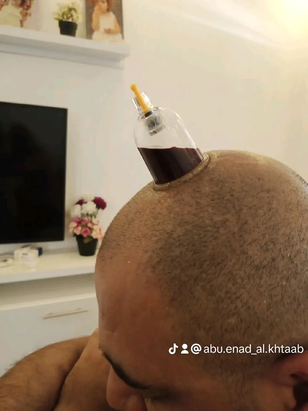 حجامة بأنواعها كايروبرايتيك شياتسو مصل النحل رقية شرعية