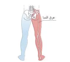 حجامة وطب بديل ومساج علاجي