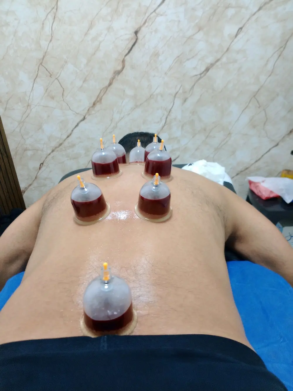 أبن جُبران للحجامة والمساجي العلاجي والاسترخائي